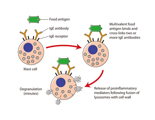 Mechanism Of Food Allergy Dr Gail Davis